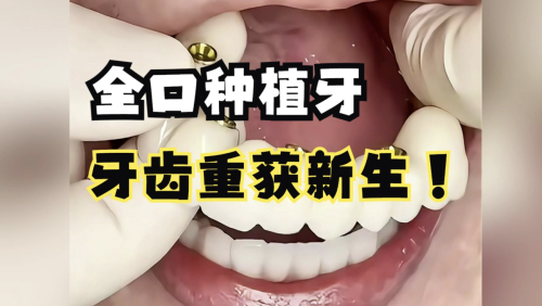 北京哪家口腔医院种植牙比较好?这几家给我冲!