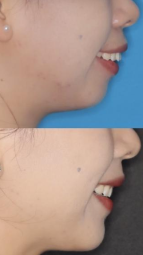 北京哪家口腔医院矫正牙齿比较好？来看看矫正界的 “妙手仁心”