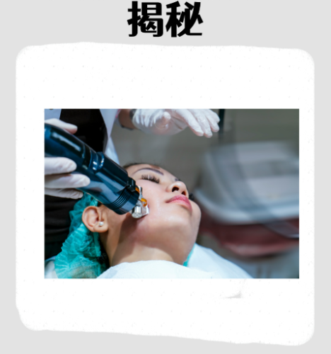 广州曙光医院祛斑要多少钱？看完直接拿捏预算