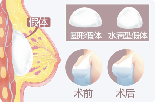 截屏2025-07-11 19.37.50.png