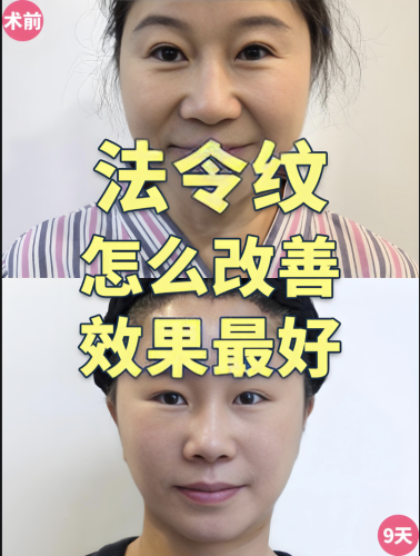截屏2025-07-12 15.10.21.png