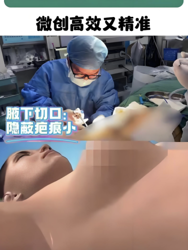 上海第九人民医院丰胸手术怎么样？自然+个性化+美学设计，闭眼冲不踩雷​