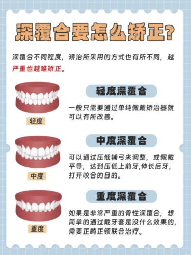 截屏2025-07-17 22.46.22.png