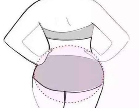 臀假体都有哪些品牌？这几个主流品牌帮你划重点