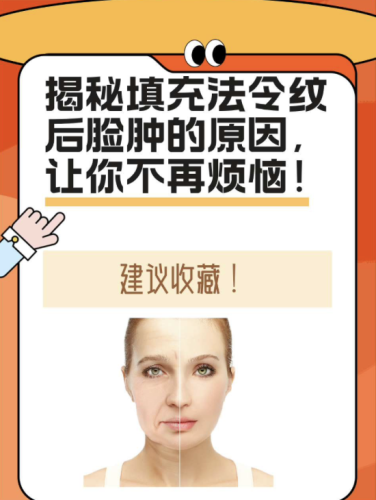 截屏2025-07-19 07.56.48.png