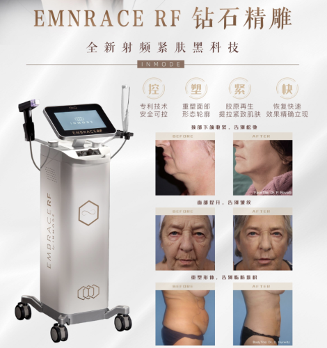 钻石金雕多久看到效果啊？减脂塑形+紧致抗衰一键搞定