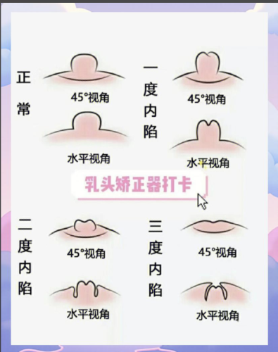 截屏2025-07-20 11.53.58.png