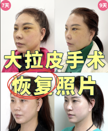 截屏2025-07-22 22.58.31.png