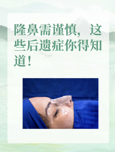 做隆鼻有后遗症吗？来探讨华丽变身背后的风险