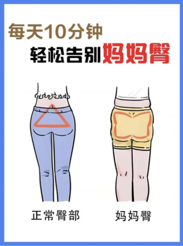妈妈臀特别大怎么消除?有效方法全解析