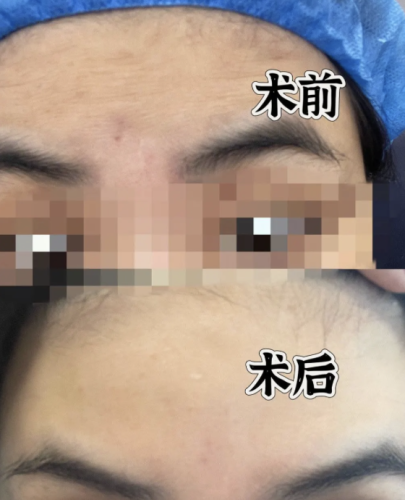 嘉兴第一医院除皱手术怎么样？成了很多人重拾青春容颜的希望
