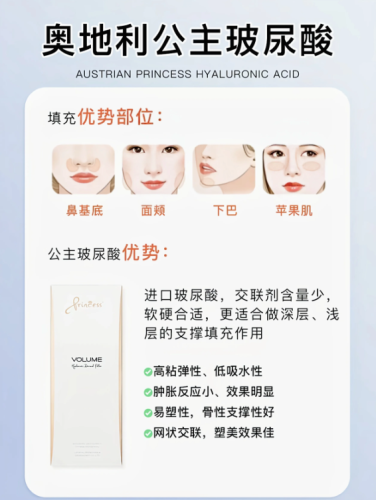 奥地利公主玻尿酸填充能维持多久?时间在5至12个月左右