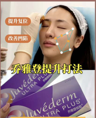 乔雅登打提升效果明显吗？不同系列的提升效果有差异