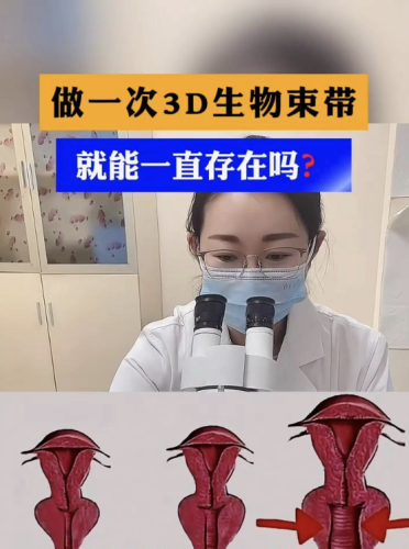 3d生物束带紧缩术能维持几年？本文将为你深入剖析这一疑问