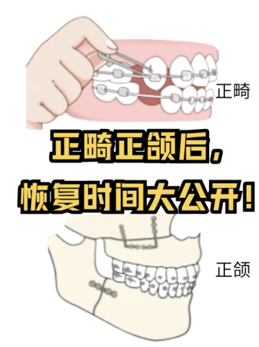 做正颌手术的十大忠告：能帮你少走不少弯路