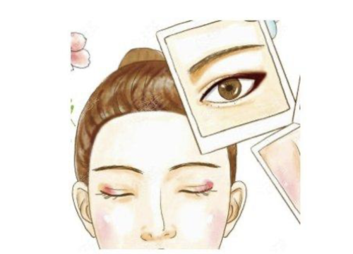 双眼皮哪里技术好？求美者应综合多方面因素再做选择