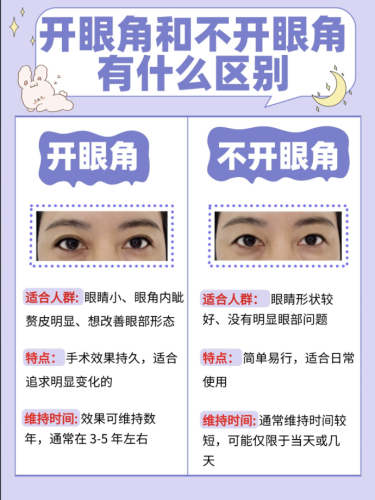 做双眼皮开眼角好还是不开眼角好？听我说！这事儿真没标准答案，关键看适配度