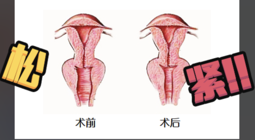 国药东风总医院私密整形怎么样？妥妥的“别人家的医院”！