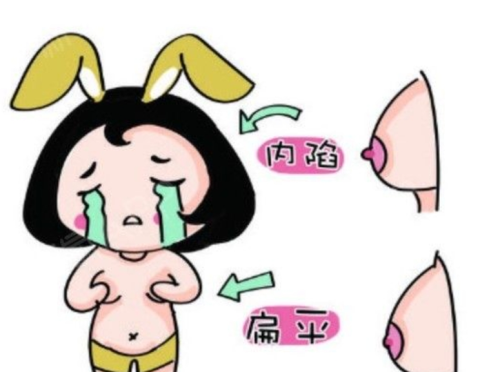 乳头内陷手术后多久恢复？术后流程风险价格全解析