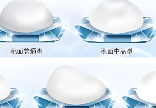 曼托圆形光面和毛面有什么区别？答案全在这里了