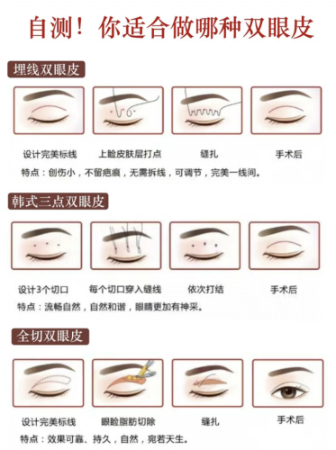 广西民族医院割双眼皮多少钱？为大家对比一下三种手术方式的价格和特点