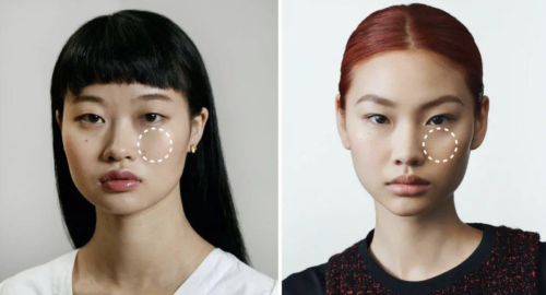 颧骨高怎么办？约86%的人反馈医美效果明显