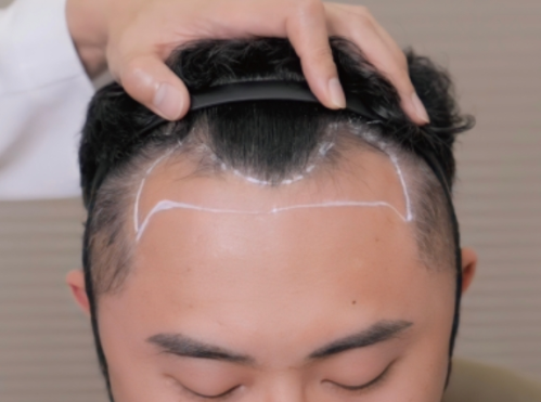 微信截图_20250808175227.png
