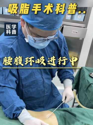 哈尔滨瑞丽吸脂怎么样？环形负压吸脂，让脂肪“乖乖听话”