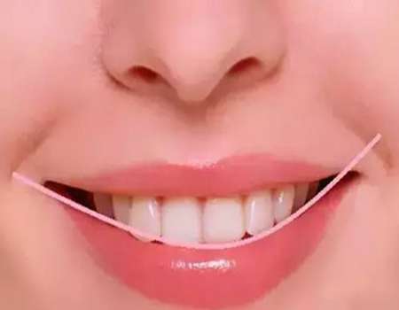 深覆合是什么样子的？不止是牙齿“咬太深”，这些细节你该知道