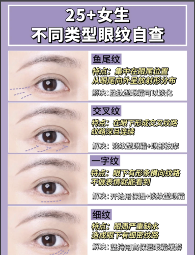 哈尔滨瑞丽做眼纹多少钱？整套下来3000-15000元，眼周肌肤光滑紧致