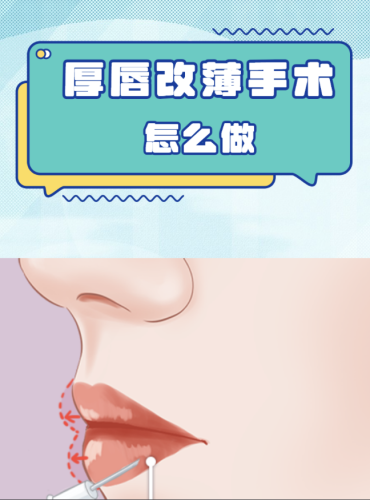 做厚唇改薄会留疤吗？3大“疤痕雷区”要避开