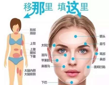 婕尔和伊婉的区别是什么？大白不会告诉你的3个细节