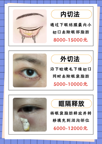 黑龙江艺星整形去眼袋价格：报价从 1800 到 1.2 万差出 6 倍，价格表藏着这些省钱招