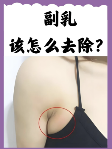 截屏2025-11-23 10.21.31.png