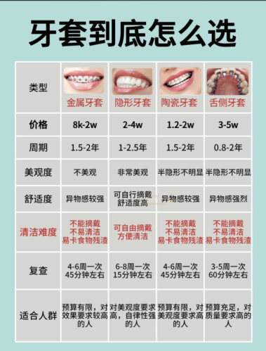 上海易美口腔牙套价格表2025版，附省钱攻略+真实案例