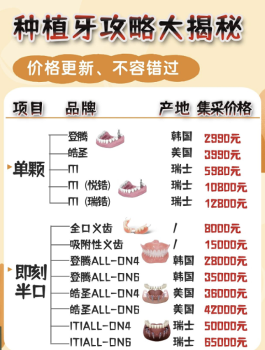 北京协和医院种牙收费标准2025：6800元起！含单颗/半全口+集采省钱攻略