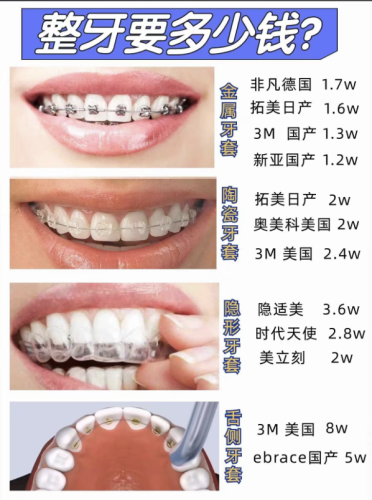 胜利油田中心医院矫正牙齿多少钱？不同矫正方案价格&适配人群对比