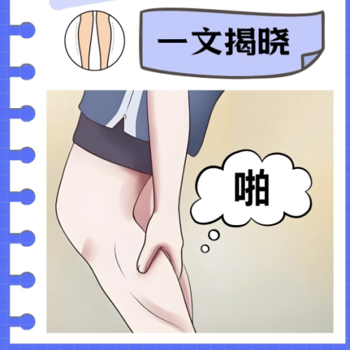 腿部拉皮一般大概多少钱？真实案例+费用拆解，不花冤枉钱