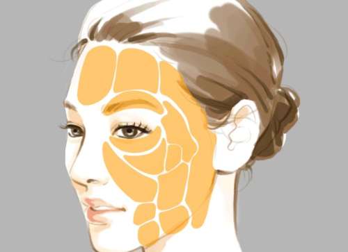 自体脂肪全脸填充动漫.jpg 自体脂肪全脸填充动漫.jpg