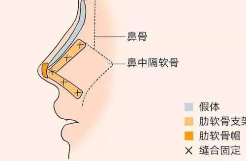 【重庆整形咨询】整形美容医院医生在线咨询