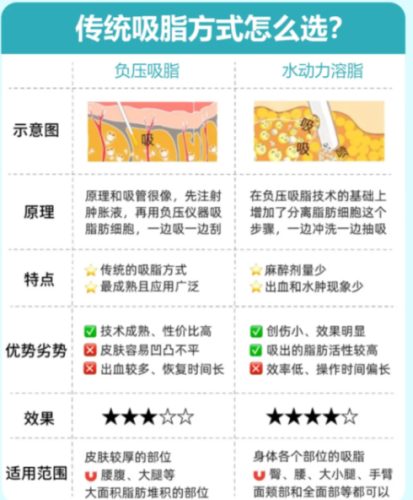 负压吸脂和超声波吸脂哪个好?医生实测:选对术式少遭罪(附案例)