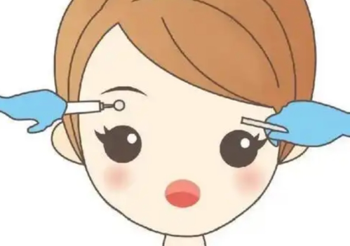 填眉弓用什么玻尿酸好？一篇说清不同产品在支撑力与稳定性上的真实表现