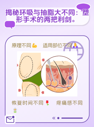 环吸和抽脂有什么区别？先搞懂这2个核心差异再决定