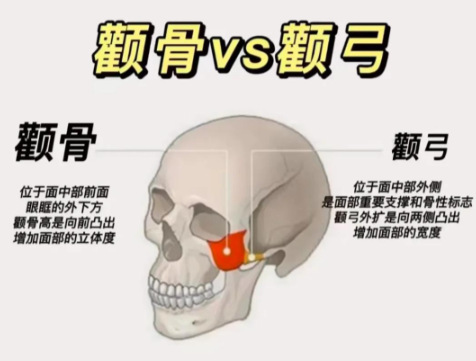 颧弓内推和颧骨内推的区别：别再傻傻分不清！这俩手术差的不只是“两个字”