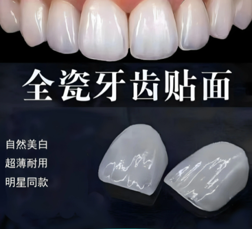 铸瓷贴面和烤瓷贴面的区别：别再瞎选！手把手教你挑对牙齿 “美颜衣”