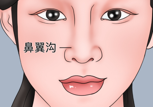 打鼻唇沟用什么玻尿酸？医生最常推荐的几个品牌详细解析