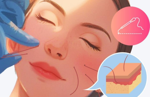 额部提升手术有几种做法?不同切口思路适合哪些人群